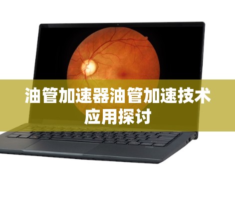 油管加速器油管加速技术应用探讨